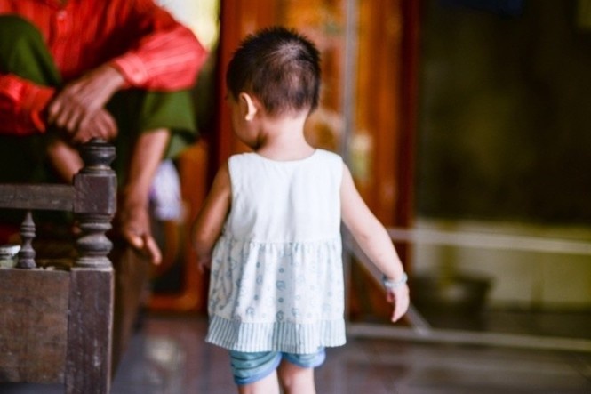 Trẻ ho kéo dài một tháng, bác sĩ phát hiện dị tật hiếm gặp