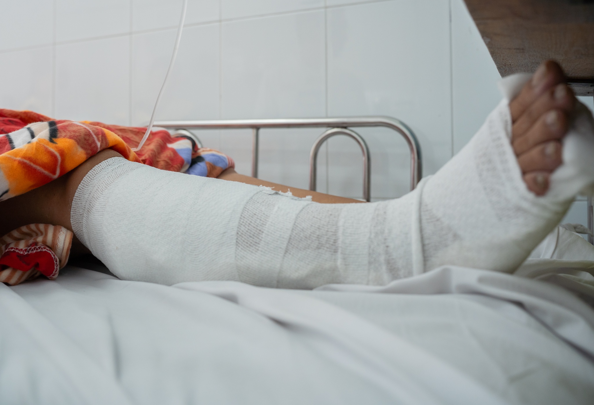 Vụ nhánh cây rơi trúng vợ chồng ở TP.HCM: Tình hình sức khỏe người vợ