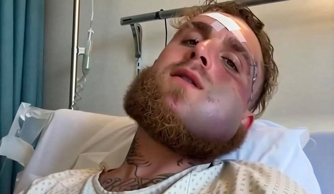 Mat Jake Paul bien dang hinh anh