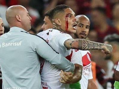 Duoi danh trong tai, doi truong tuyen Peru sap bi phat nang hinh anh