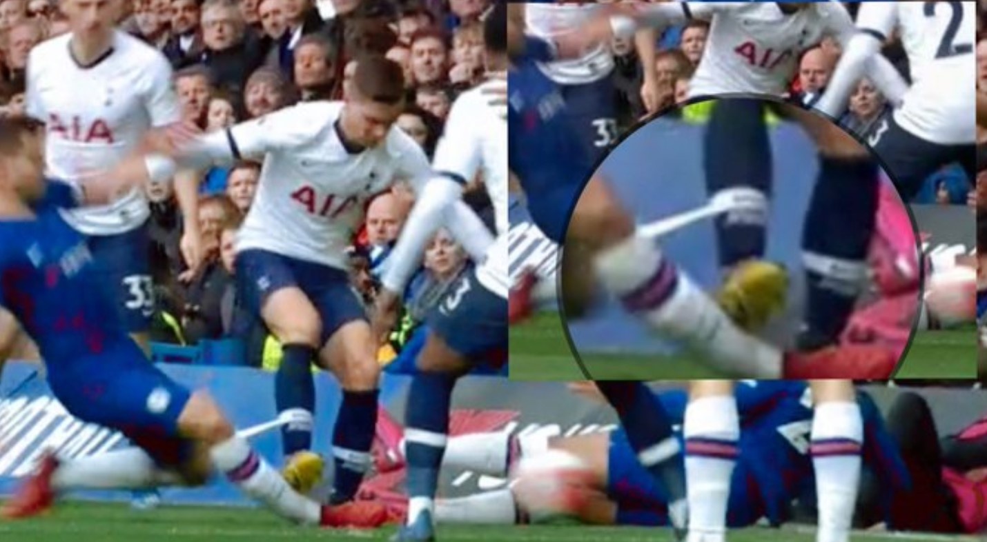 lo celso thoat the do anh 1