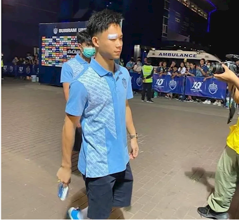 supachok khau 19 mui anh 1