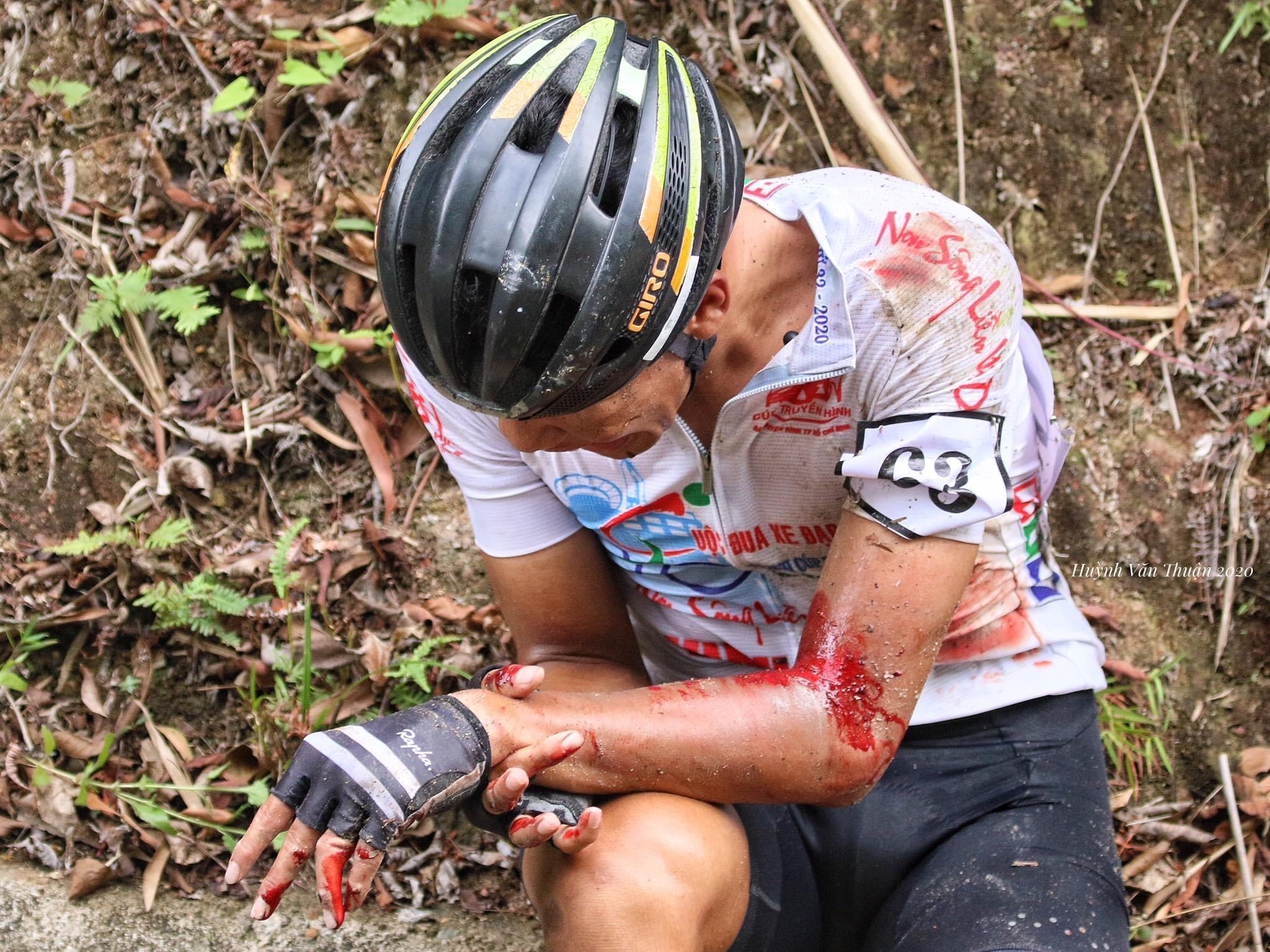 Gay xuong ngon tay, ao trang Vo Thanh An chap nhan bo cuoc hinh anh