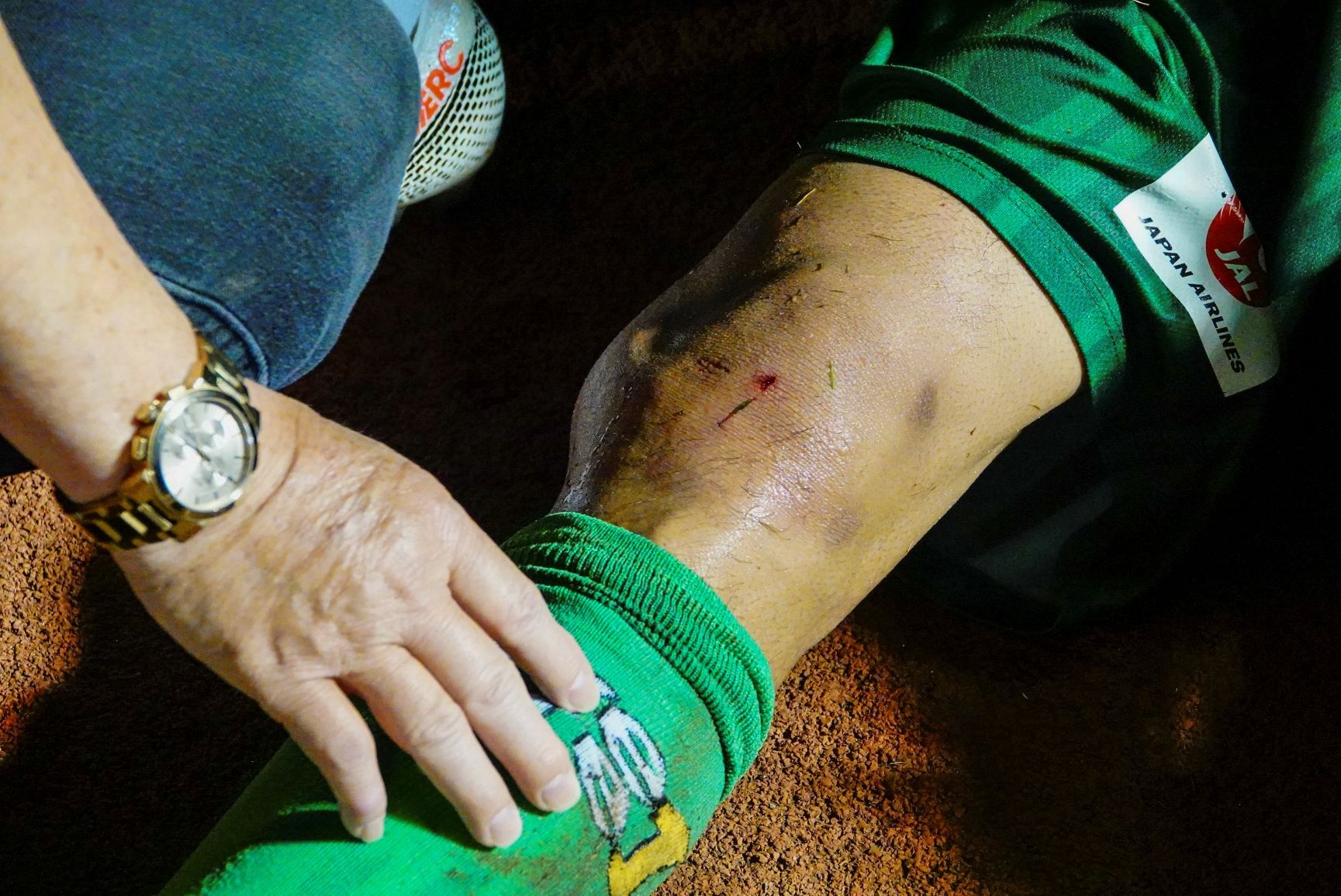 Dau goi cau thu doi Sai Gon bien dang sau cu dap hinh anh