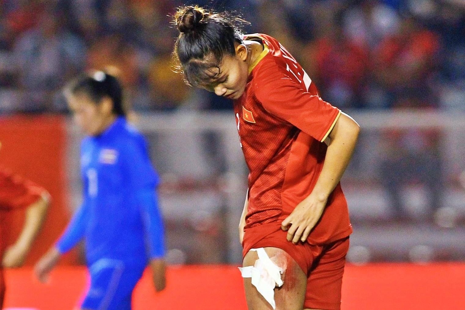 Chan rom mau cua Chuong Thi Kieu hinh anh