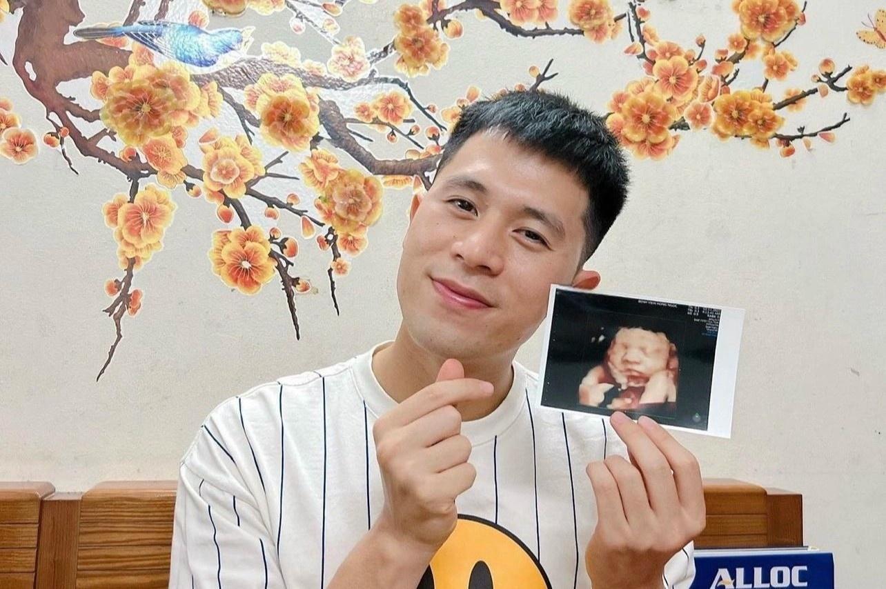 Dinh Trong sap co con dau long hinh anh