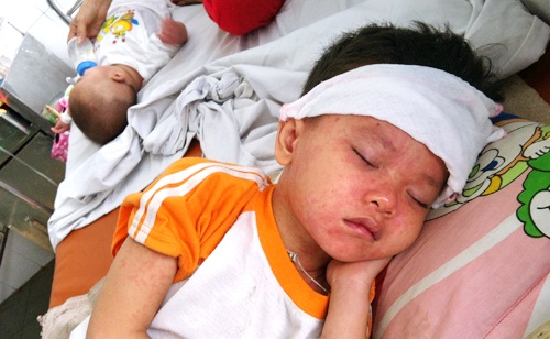 Dich soi quay lai Ha Noi, co nguy co lan nhanh hinh anh