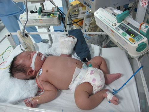 Be so sinh hoai tu ca ban tay da tu vong hinh anh