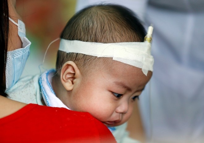 Chiem 50% ca tu vong do soi, Ha Noi van khong cong bo dich hinh anh