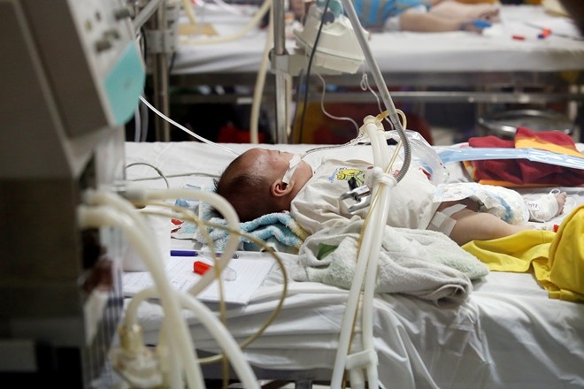 2 benh nhi xin ve vi nhiem soi qua nang hinh anh