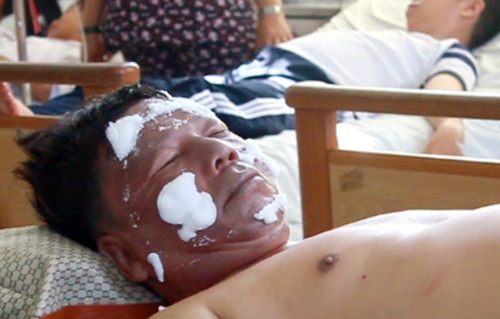 Vi sao bong bay phat no khien hon chuc thay tro nhap vien? hinh anh