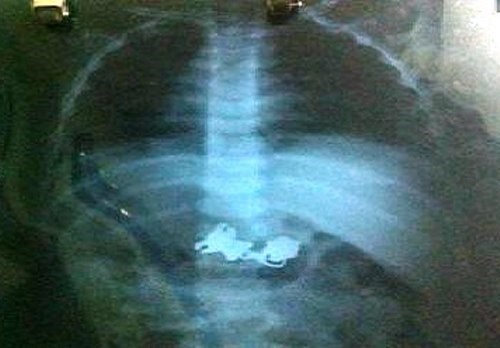 Mo lay chia khoa trong da day be 25 thang tuoi hinh anh