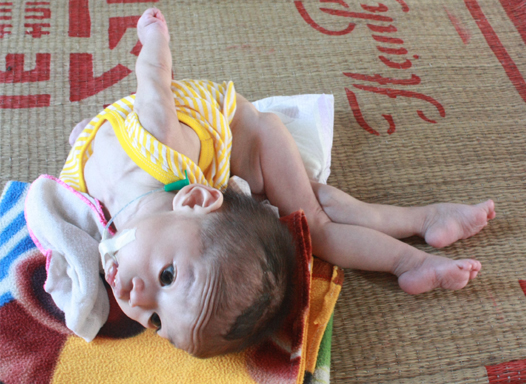 Hoan canh bi tham cua chau be bai nao 2 tuoi, chi nang 3,5kg hinh anh