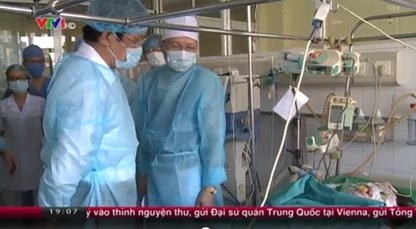 Cac chien si tren may bay roi bi bong 50-70% hinh anh