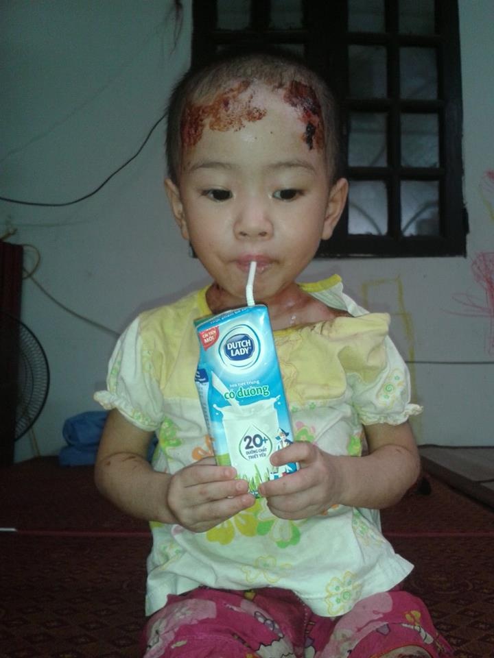 Xin duoc dua chau be 'co gioi' o chua Bo De di chua benh hinh anh