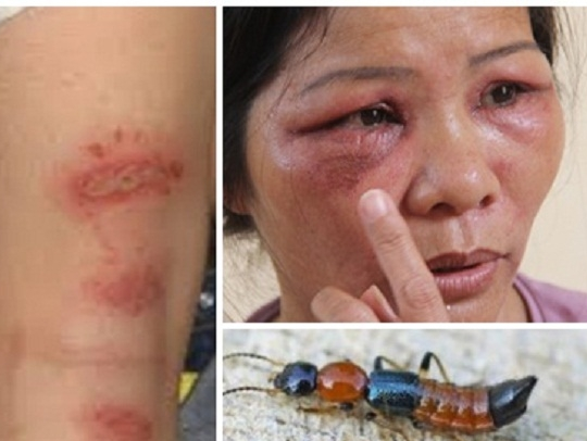 Hieu dung de khong chiu hau qua dang tiec tu kien ba khoang hinh anh