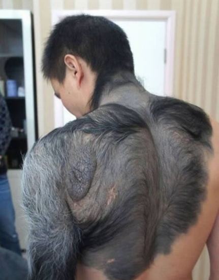 Nhung vet bot ky la nhat the gioi hinh anh