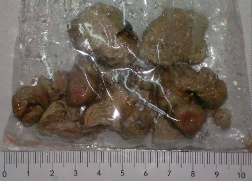 Rung minh nhung vien soi 'luc nhuc' trong co the hinh anh