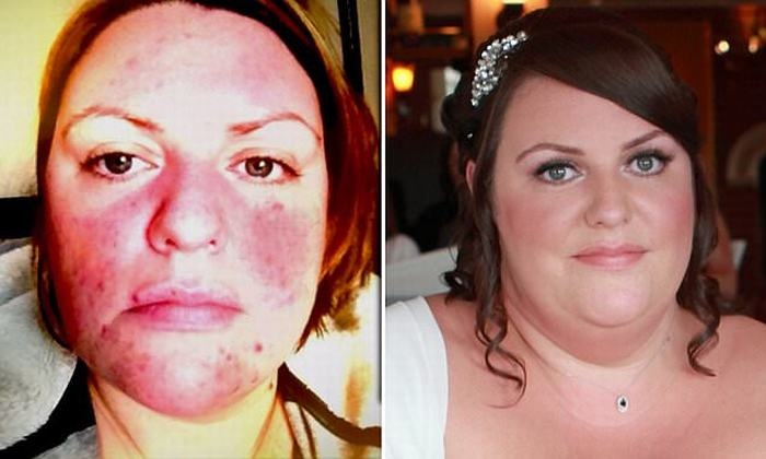 Thuoc nhuom toc lam bien dang mat hinh anh