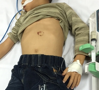 Nga xe dap, co tuy be trai 7 tuoi vo lam doi hinh anh