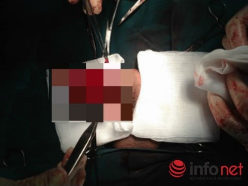 Muon chuyen quy ong nhap vien cap cuu vi 'cua quy' bi thuong hinh anh