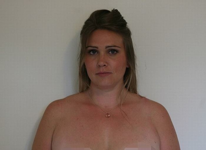 Cat bo nhu hoa vi hoai tu sau nang nguc hinh anh