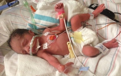 Mot phu nu thiet mang sau khi sinh bon hinh anh