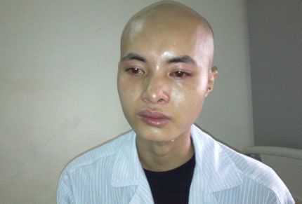 Ba quan niem sai lam thuong gap ve benh ung thu hinh anh