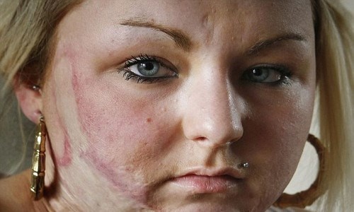 Bong toan than vi dot soi chi thua tren vay hinh anh