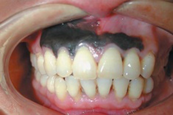 Can canh benh tat tan pha co the du doi hinh anh