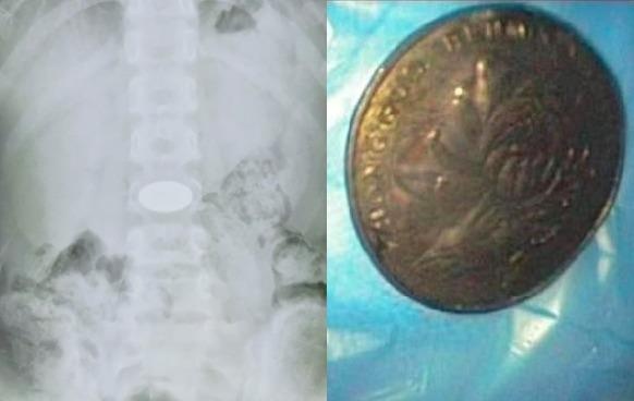 Tron lam bai tap ve nha, cau be nuot chung dong xu vao bung hinh anh