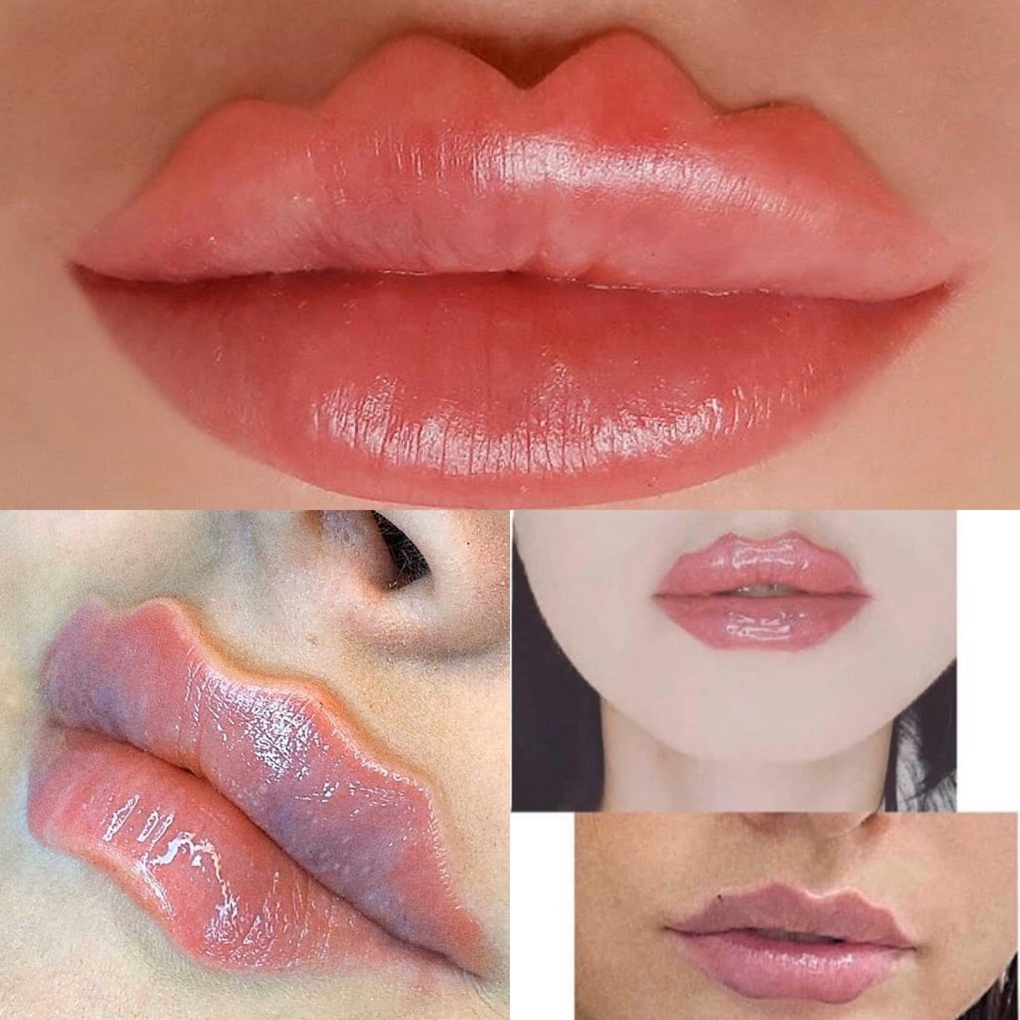 môi bạch tuộc ảnh 2 moi bach tuoc anh 2