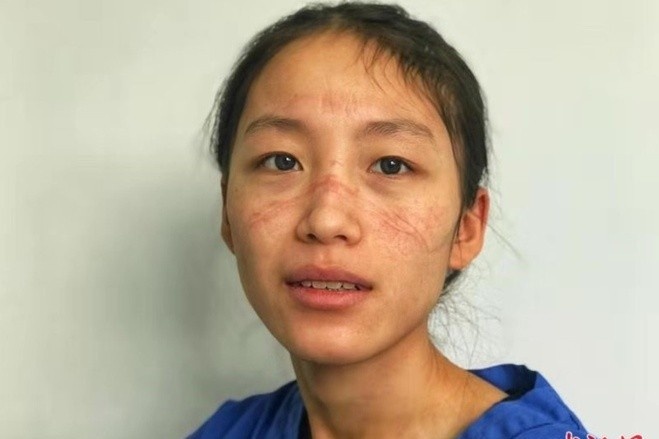 'Ve sinh ca nhan ngay den do cung la dieu xa xi voi cac y bac si nu' hinh anh