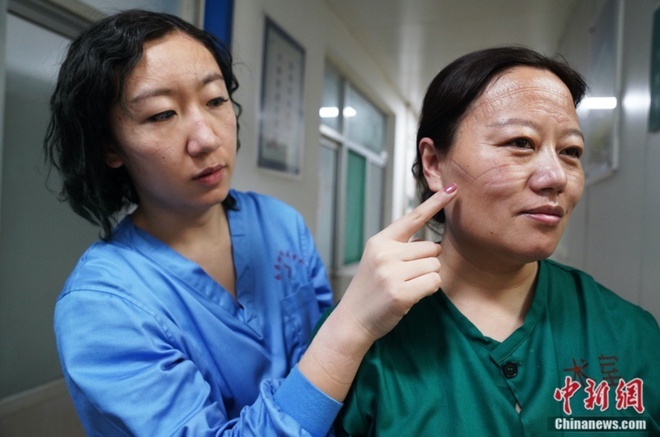 bác sĩ chiến đấu virus corona ảnh 3 bac si chien dau virus corona anh 3