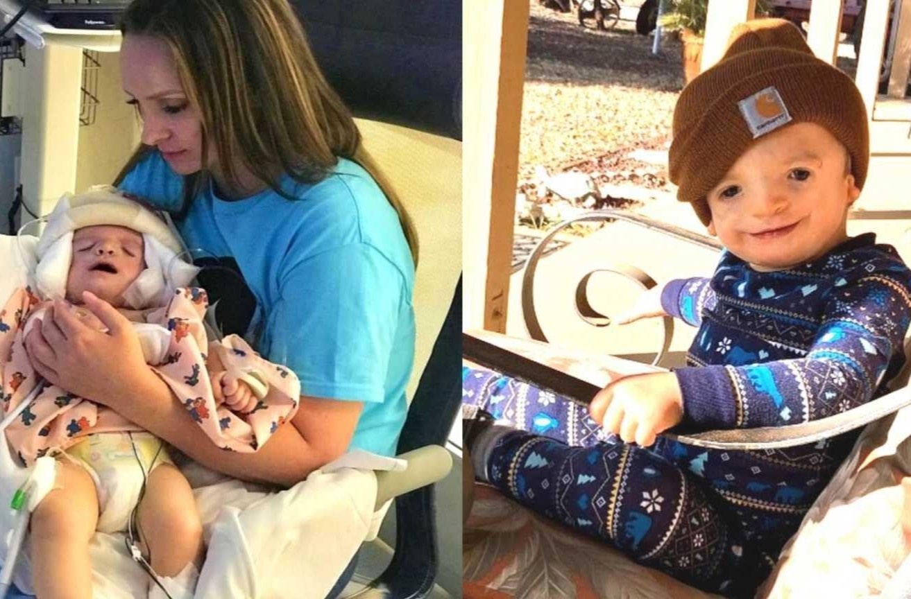 Cuoc chien cua cha me cau be 3 tuoi bi di tat, lech mat bam sinh hinh anh