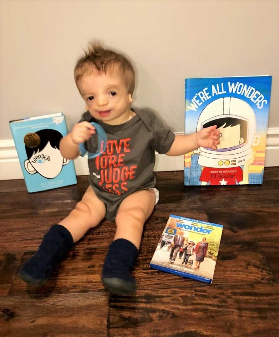 tre em bi di tat bam sinh anh 3