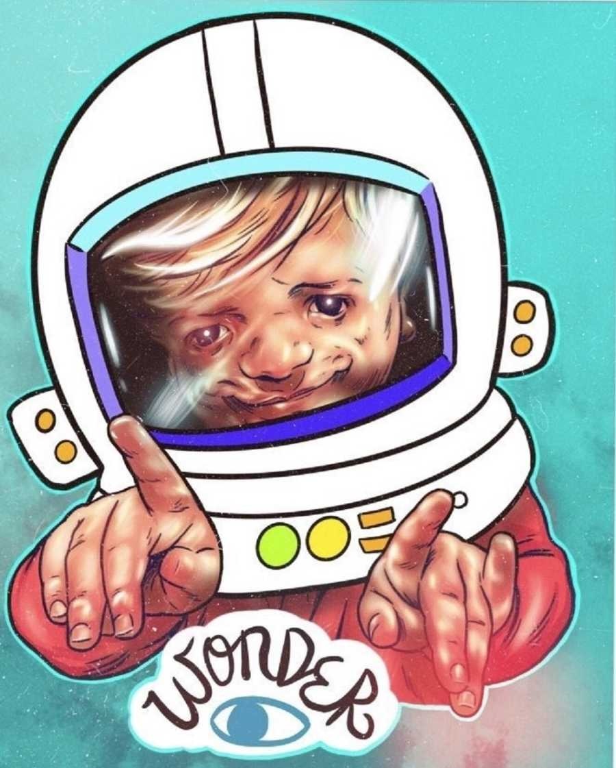 tre em bi di tat bam sinh anh 4