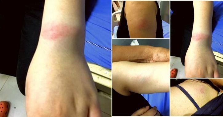 bị đánh đập vì nghi nhiễm virus ảnh 1 bi danh dap vi nghi nhiem virus anh 1