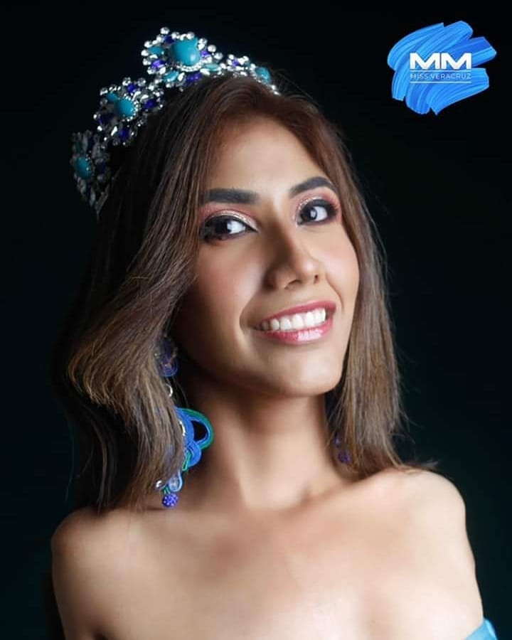 co gai cut 2 tay vao chung ket hoa hau anh 8