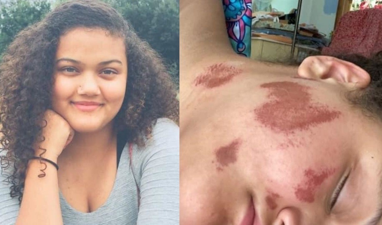 Co gai da mau bi nhom dan ong vo co cham lua dot tren pho hinh anh