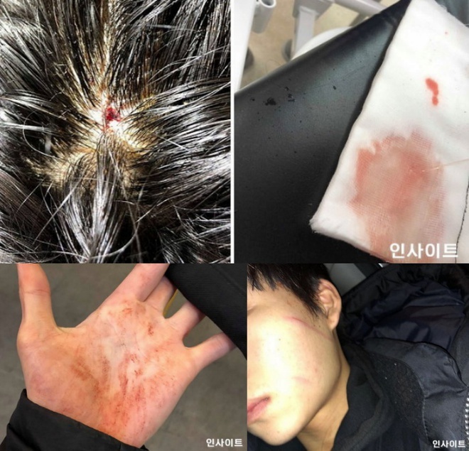 cuu thanh vien aoa bi bat nat 10 nam anh 4