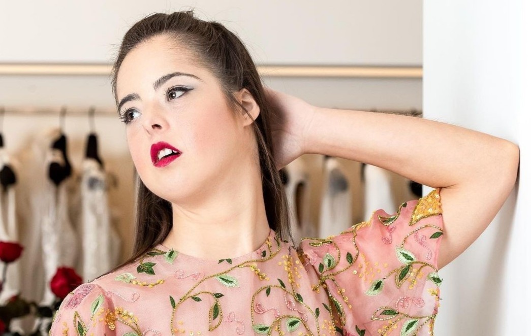 Co gai mac hoi chung Down tro thanh nguoi mau noi tieng hinh anh