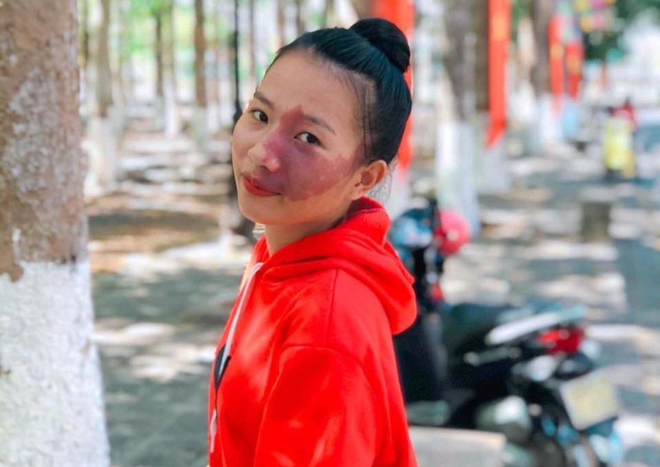 'Vet bot tren mat la mon qua cua cha me' hinh anh