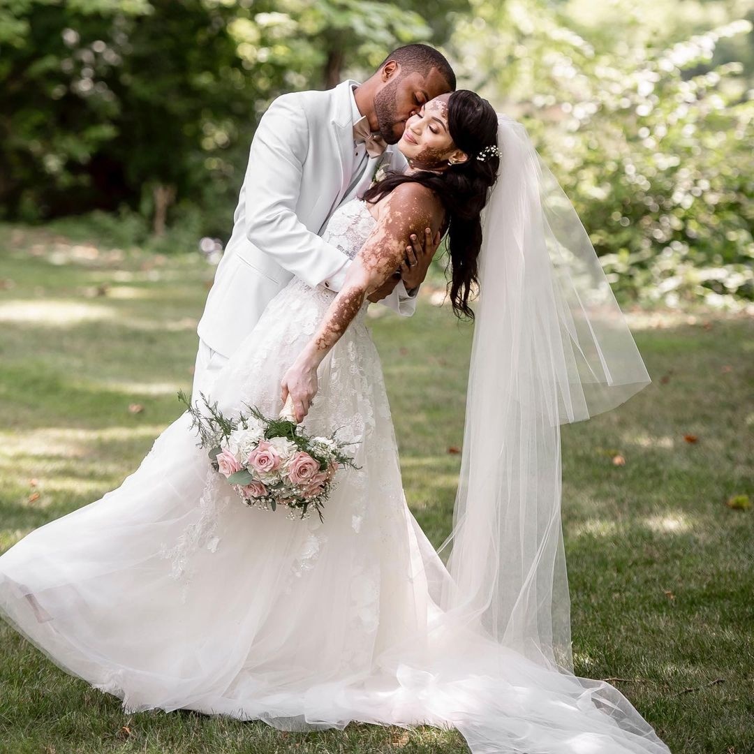 tinh yeu cua co gai mac benh bach bien anh 7