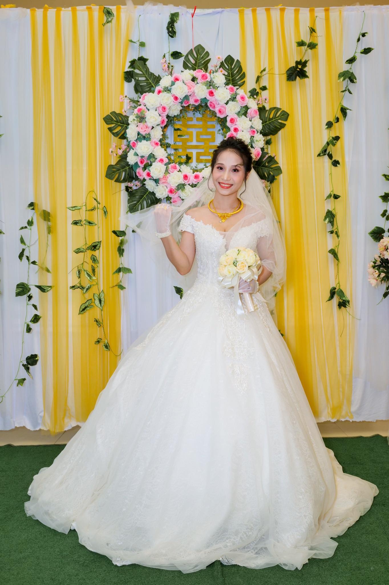 Hạnh phúc của cô gái bị bỏng mặt do xông hơi ảnh 3 Hanh phuc cua co gai bi bong mat do xong hoi anh 3