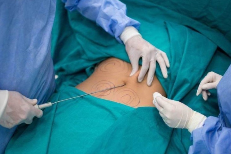 Mat trai cua nganh phau thuat tham my o Hong Kong anh 1