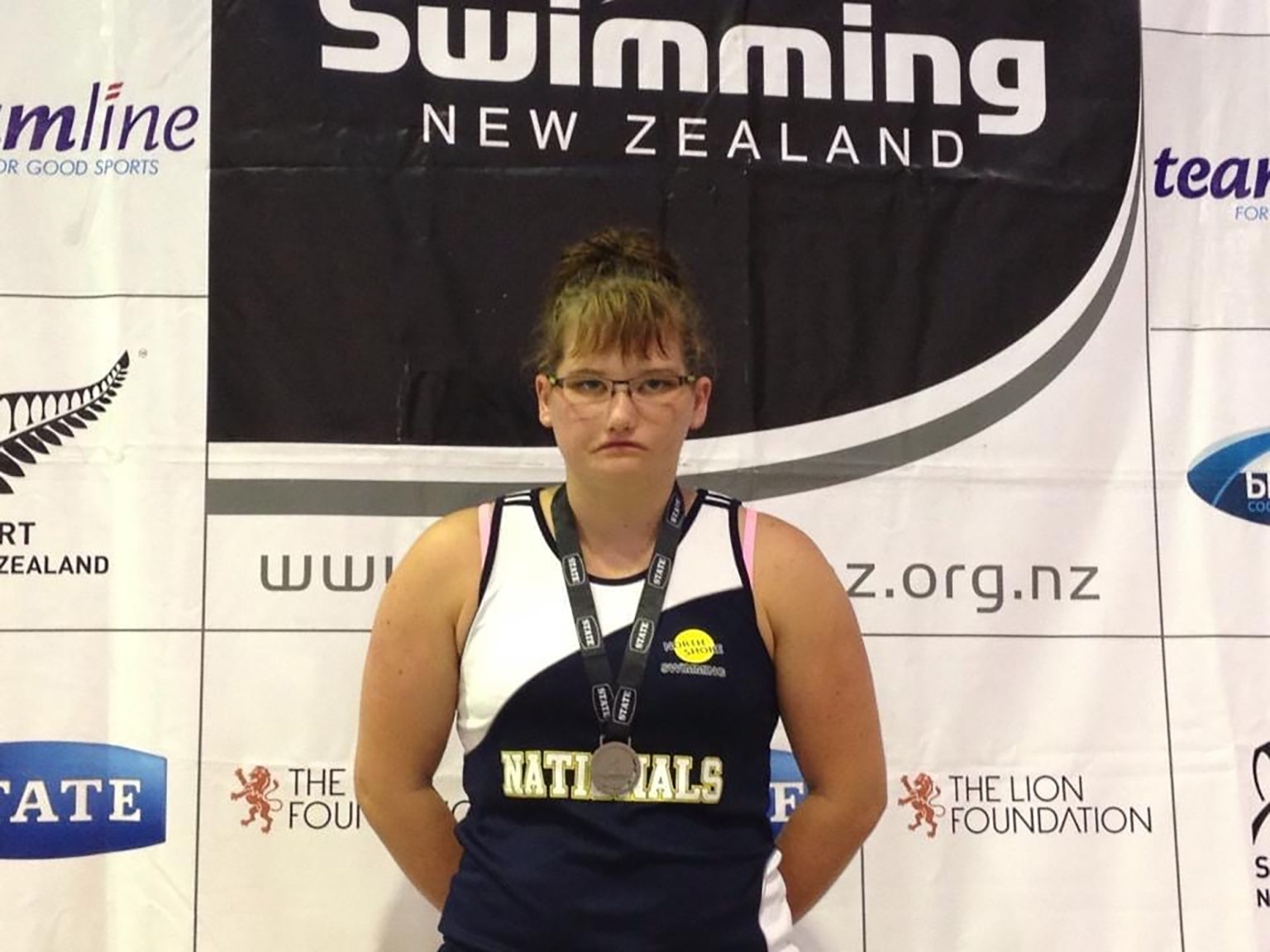 Cô gái có khuôn mặt 'không thể cười'  ảnh 2 Co gai co khuon mat 'khong the cuoi' anh 2