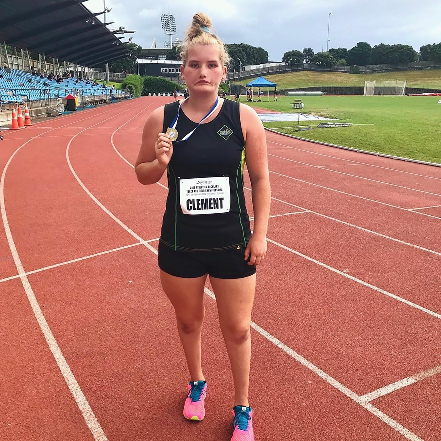 Cô gái có khuôn mặt 'không thể cười'  ảnh 4 Co gai co khuon mat 'khong the cuoi' anh 4