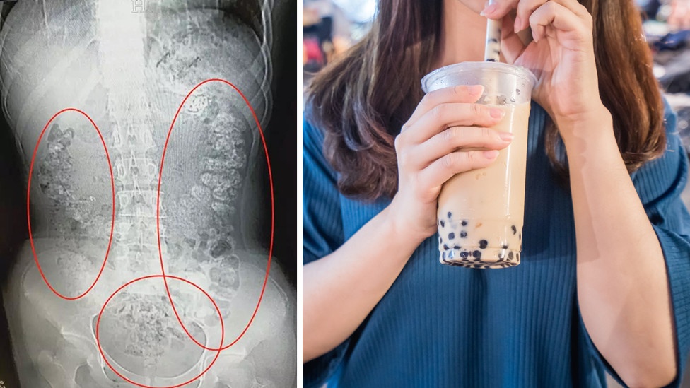 nghien tra sua tran chau anh 2