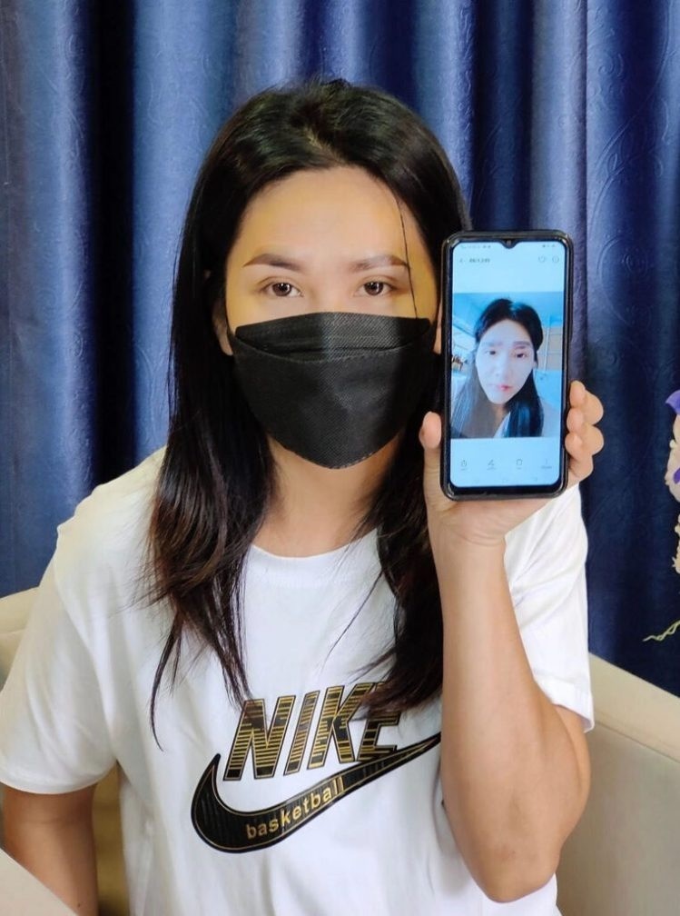 su co xam long may anh 2